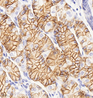 Immunohistochemistry analysis of paraffin embedded human stomach using CA-9 at dilution of 1:1000